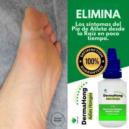 Dermahong® 3X1 – ¡Despídete de los Hongos! - 3 meses de tratamiento