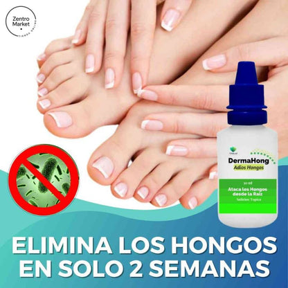 Dermahong® 3X1 – ¡Despídete de los Hongos! - 3 meses de tratamiento