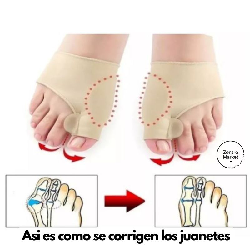 3x1 Corrector de Juanetes Ultrafino® - Comodidad al caminar