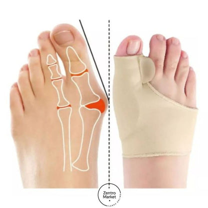 3x1 Corrector de Juanetes Ultrafino® - Comodidad al caminar